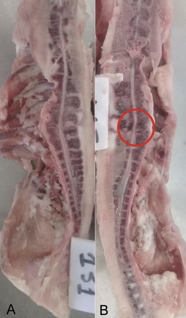 Two different cross sections show vertebrae.
