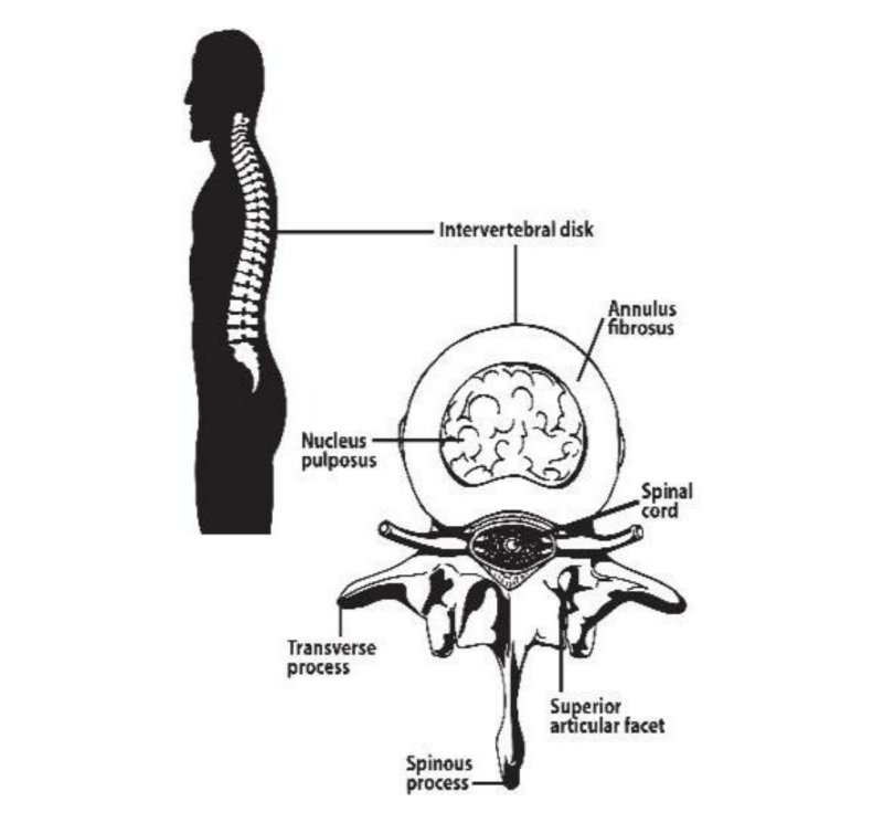 This diagram show the human back with the vertebrae and individual disks. Then a cross-section of a disc and Annulus fibrous.