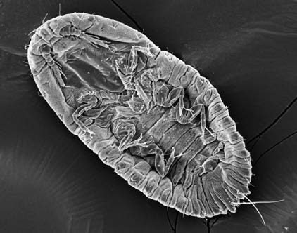 The underside of a crawler showing the legs and antennae using scanning electron microscope.